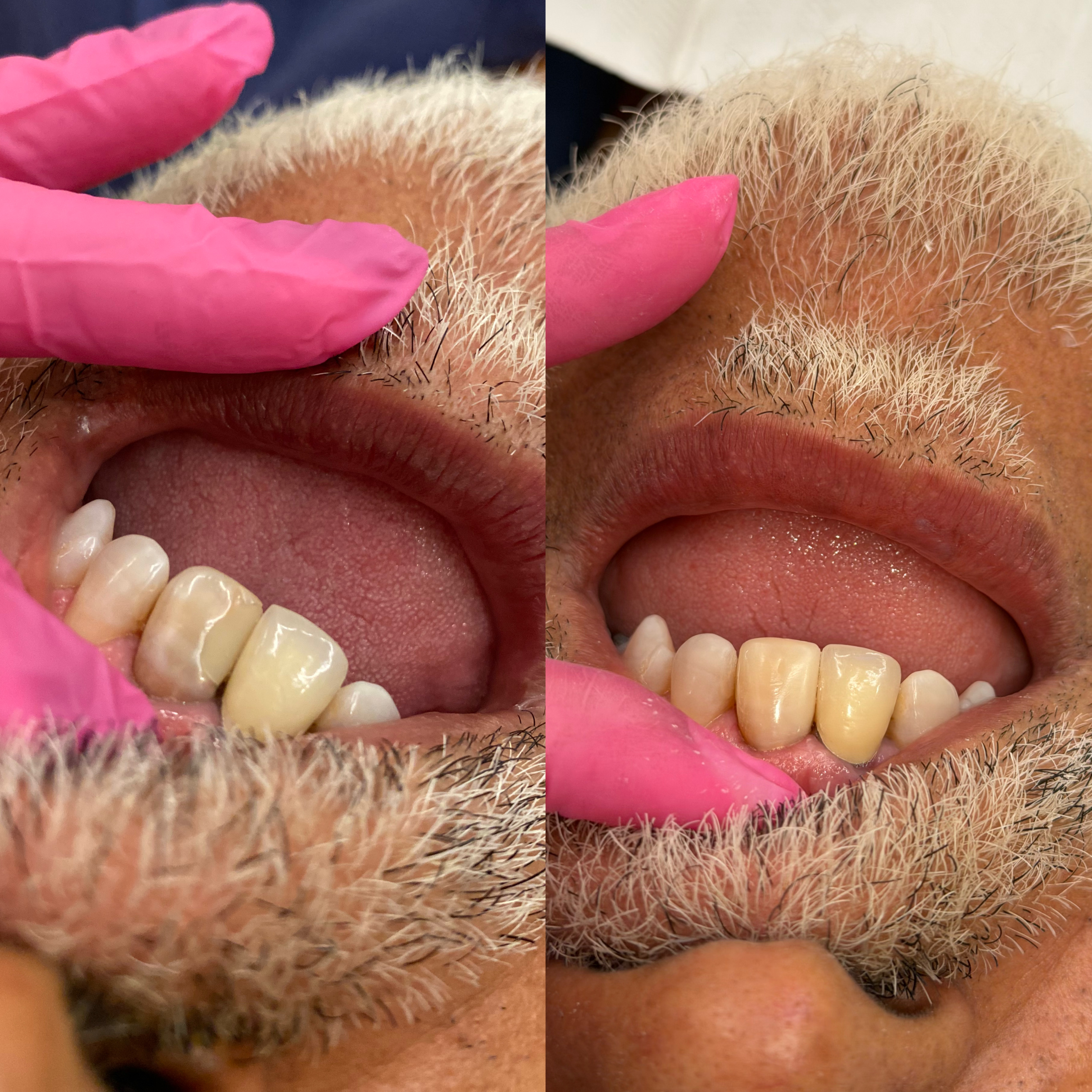 Transformação do sorriso pela Dra. Welita
