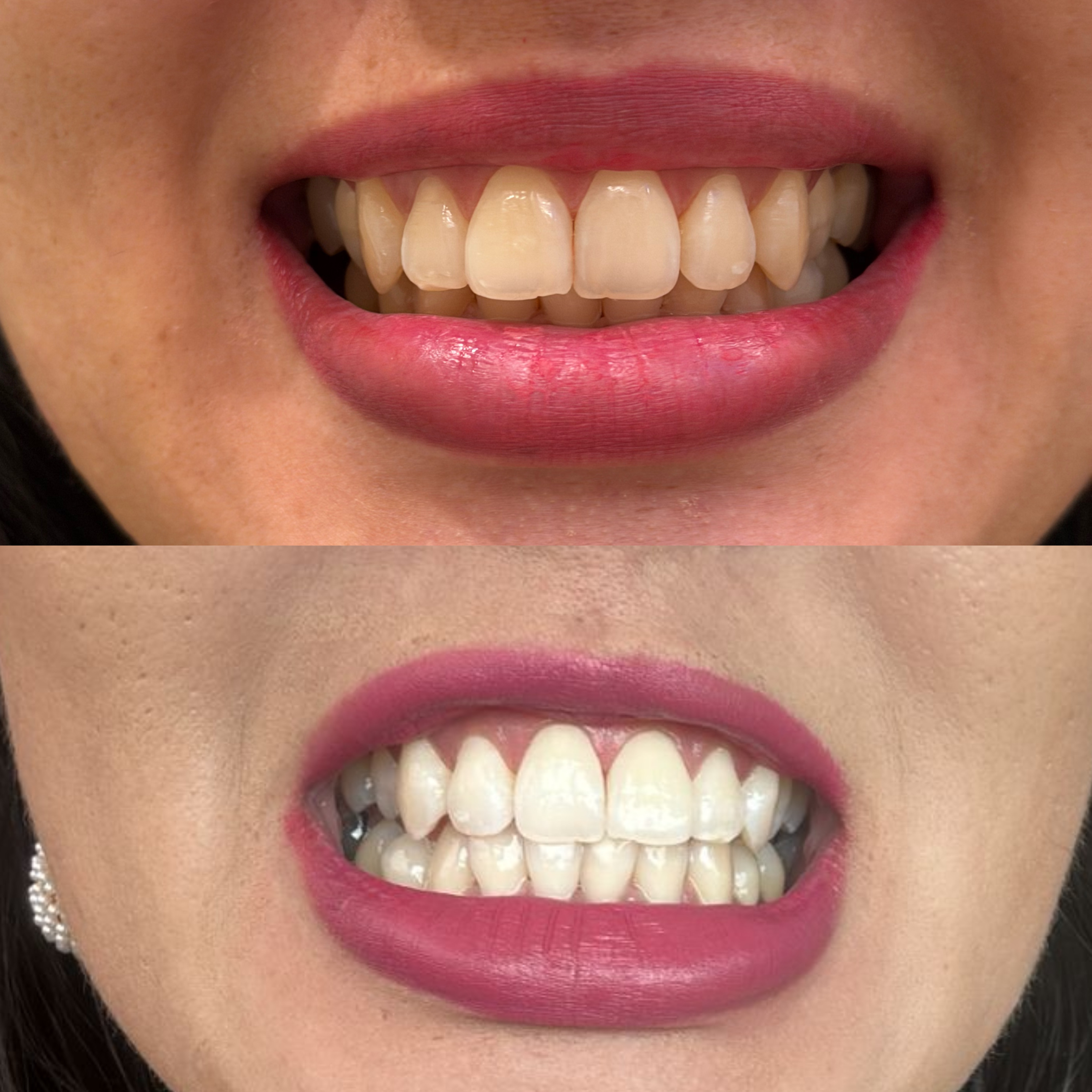 Resultado de tratamento pela Dra. Welita Caetano